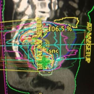 Meet your Posher, Anne